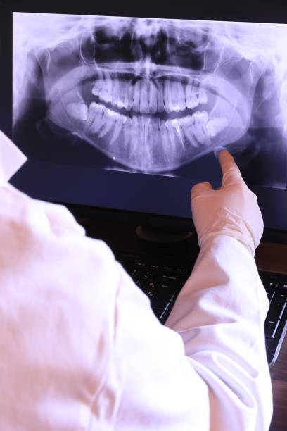 Teeth Whitening in CA