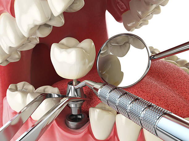Best Cracked Tooth Emergency Dentist  in Eastern Goleta Valley, CA